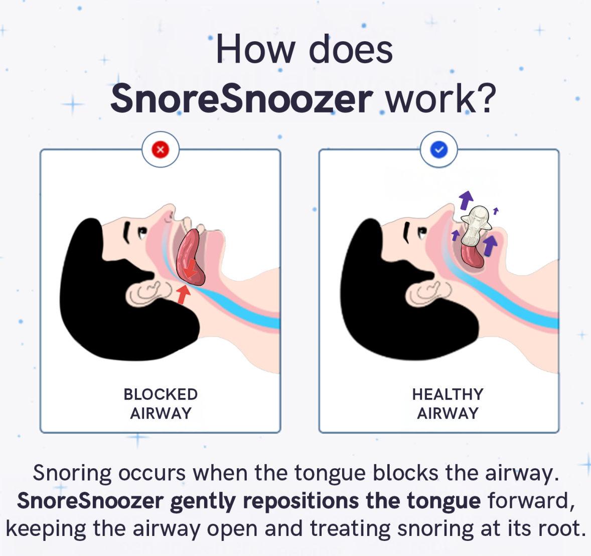 SnoreSnoozer Pro - Instant Snoring Relief